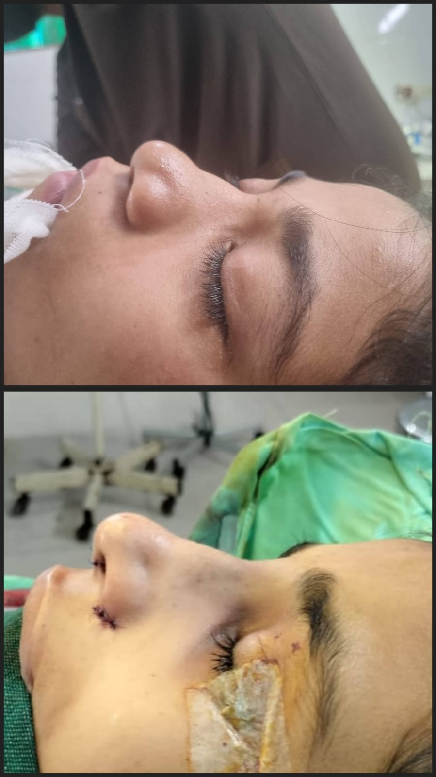 Before & After 71